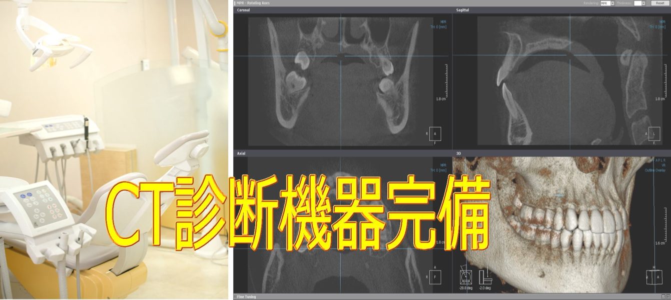 CT完備